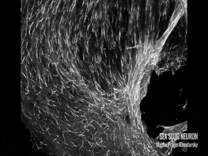 Aplysia (sea slug) neuron - Dr. Masha Prager-Khoutorsky