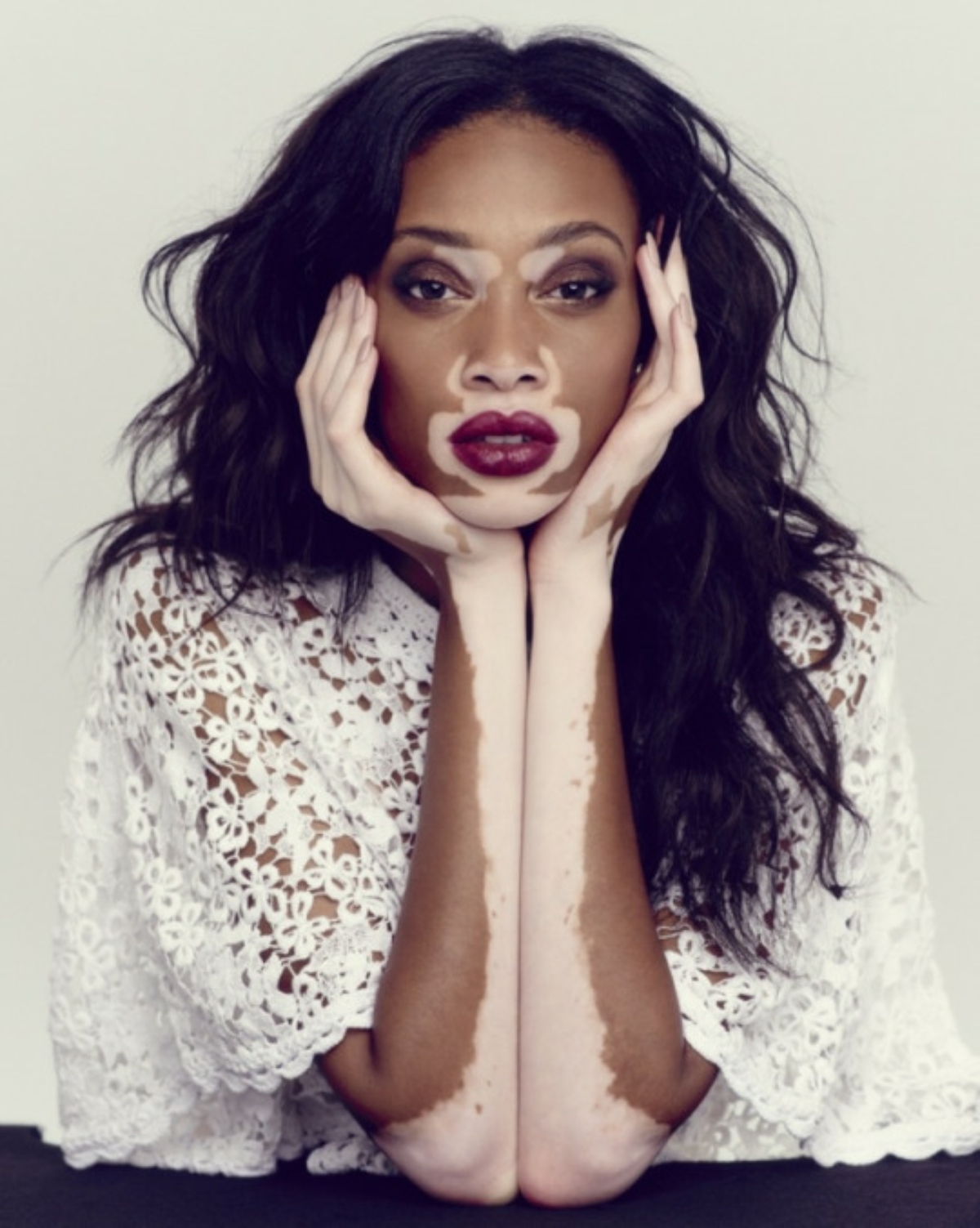I Am Not My Skin! - Chantelle Winnie