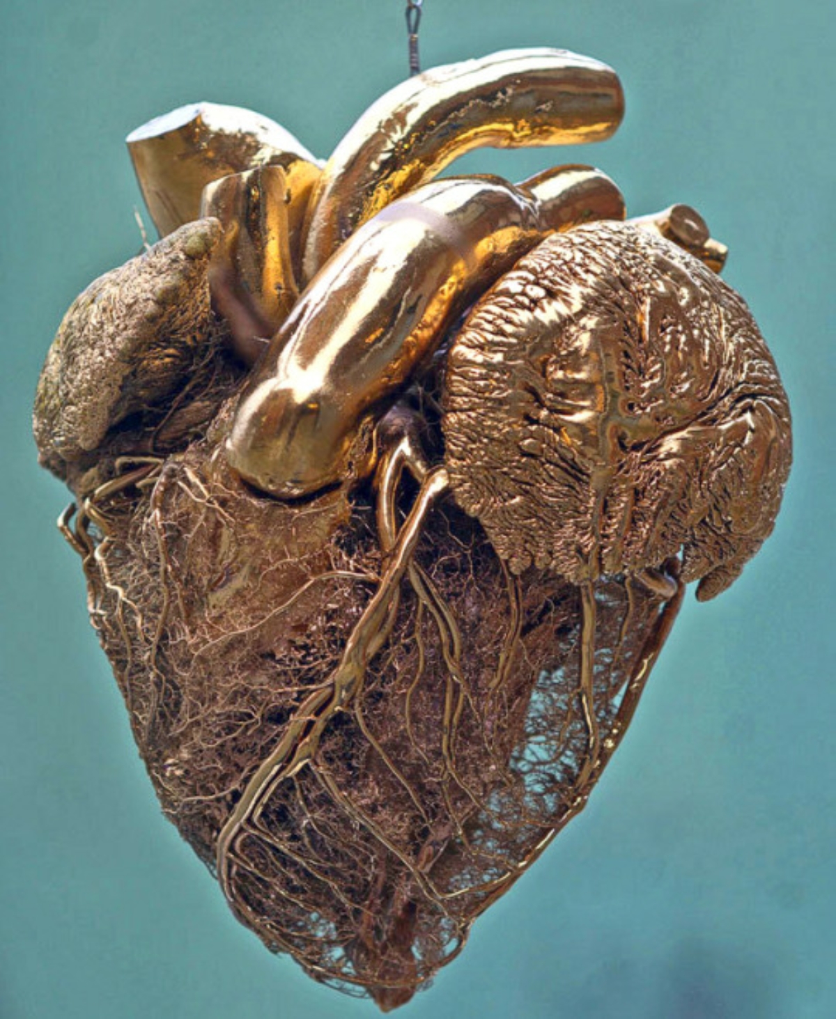 Remember, People Will Judge You By Your Actions, Not Your Intentions. You May Have A Heart Of Gold,  But So Does A Hard-boiled Egg - Ritu Ghatourey. Art by Gunther Von Hagens. Photo Vincent Fournier