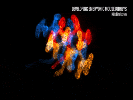Developing mouse embryonic kidneys  - Dr. Nils Lindstrom