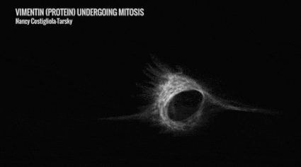 Vimentin (a protein) undergoing mitosis - Dr. Nancy Costigliola-Tarsky